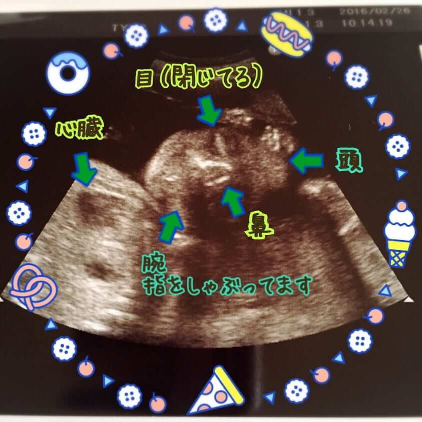 妊娠24ｗ 25ｗ 26ｗ 写真で見る胎児と妊婦の様子 妊娠7ヶ月めレポ 双子男子