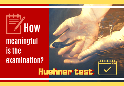 フーナーテストでの精子の泳ぎを代弁した写真です。