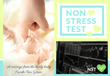 NSTの画像です。